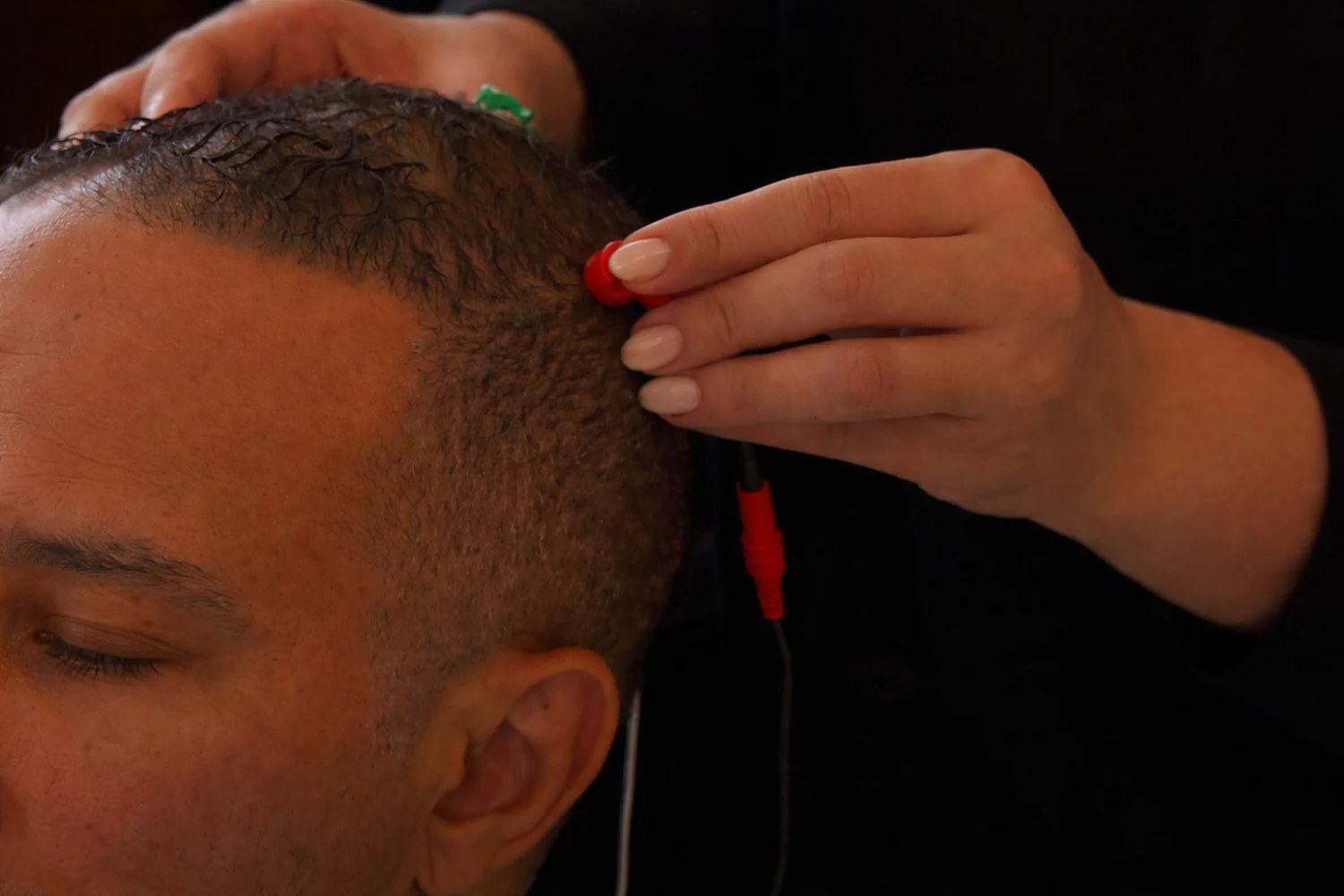 A close-up of a sensor being placed on a client's scalp for brain mapping